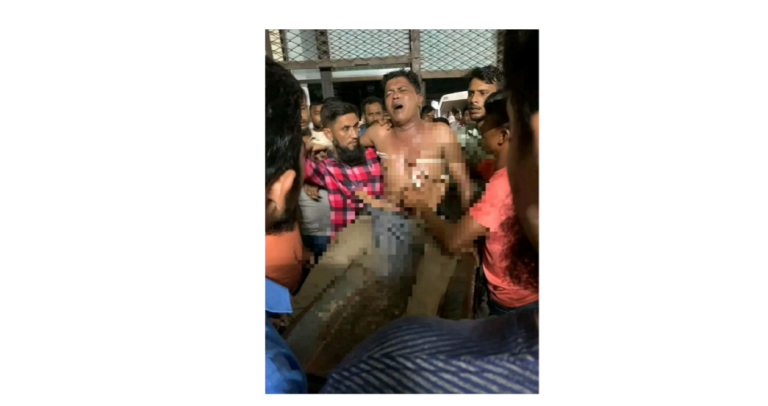 খুলনায় যুবদল নেতা বাদল গুলিবিদ্ধ, উন্নত চিকিৎসার জন্য ঢাকায় নেওয়া হচ্ছে